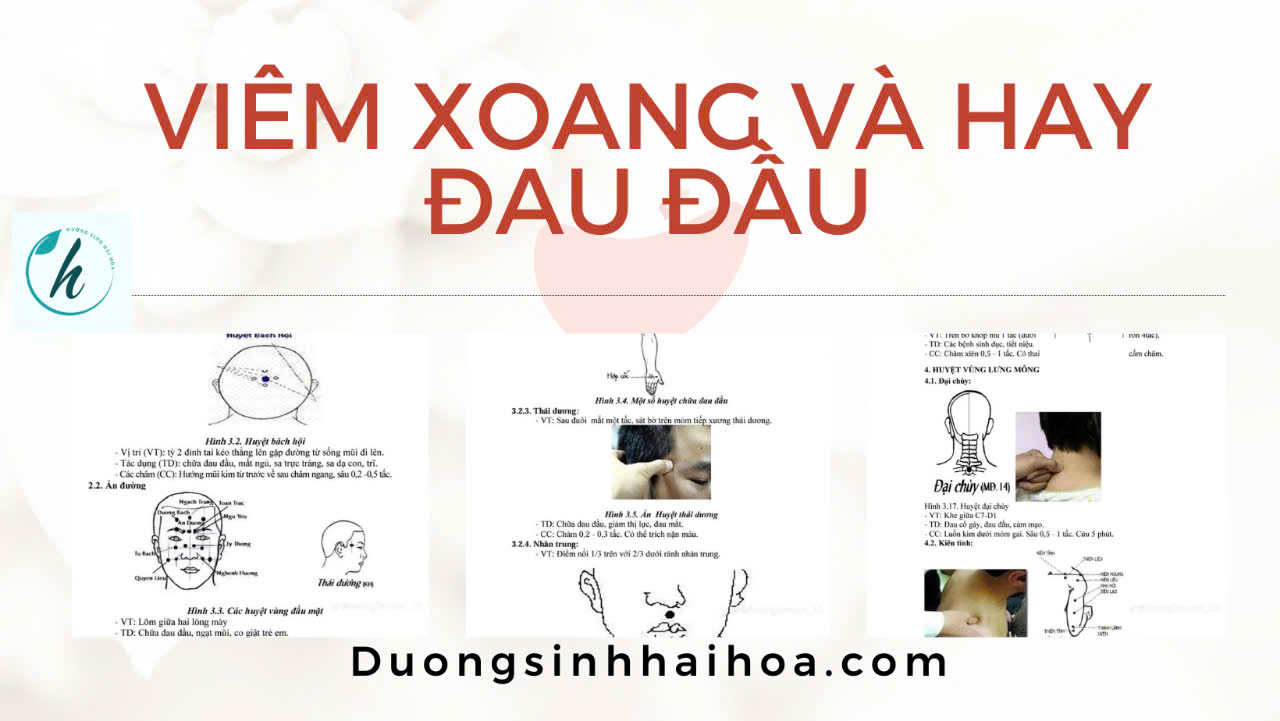 VIÊM XOANG VÀ HAY ĐAU ĐẦU