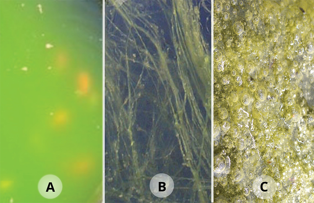 API - Algaefix | Thuốc diệt rêu tảo hại cho hồ cá thủy sinh
