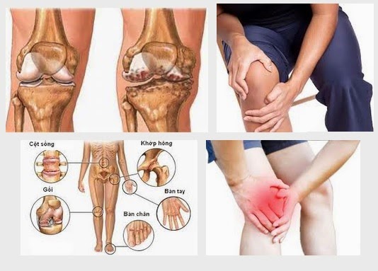 Thuốc dưỡng khớp flex giá bao nhiêu?