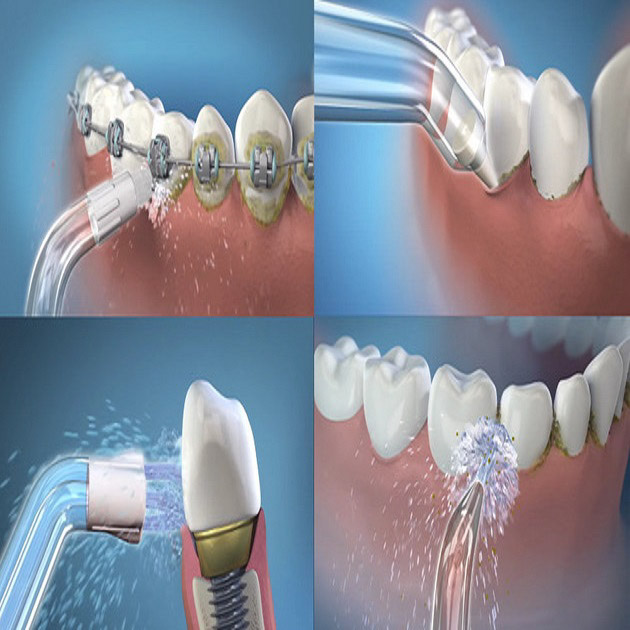 Hướng dẫn cách sử dụng máy tăm nước Maxcare đúng cách