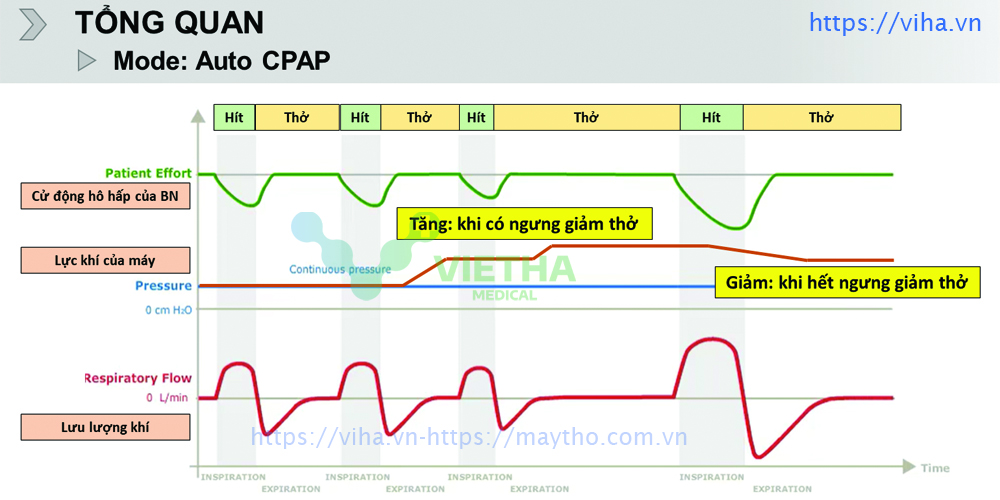 Mode Thở Auto CPAP