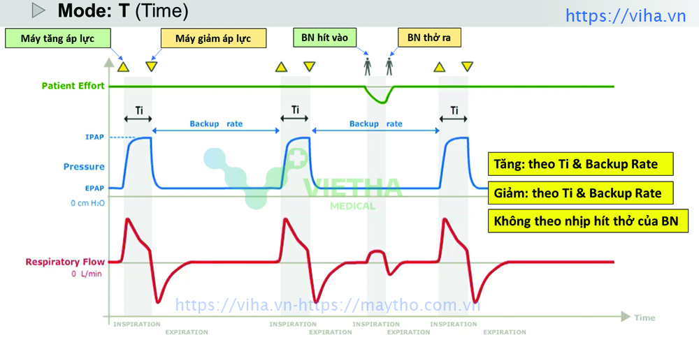 Các dòng máy thở BiPAP