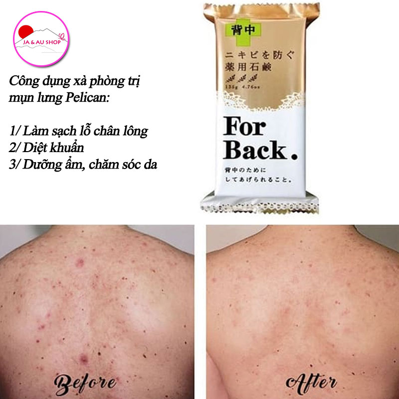 Xà phòng tắm giảm mụn lưng For Back Medicated Soap Pelican 4