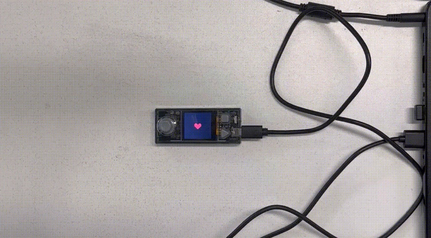 Trường hợp 18 - Nhịp tim