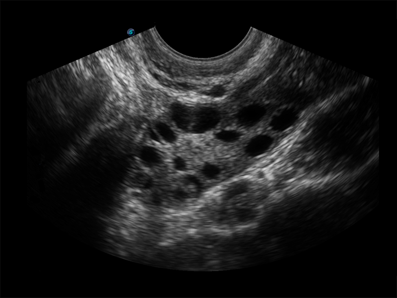 Máy siêu âm 2D Sonoscape E3