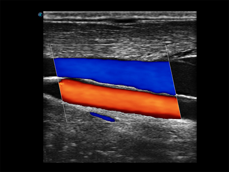 Máy siêu âm 2D Sonoscape E3