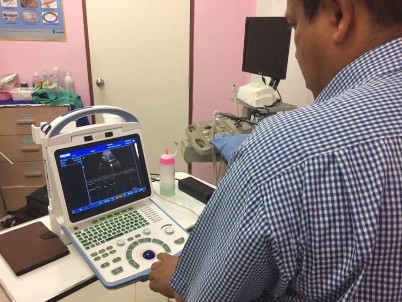 Máy siêu âm 3D CANYEARN A65