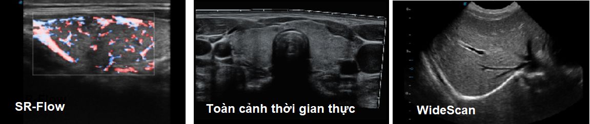 Máy siêu âm 5D Sonoscape P10 Plus