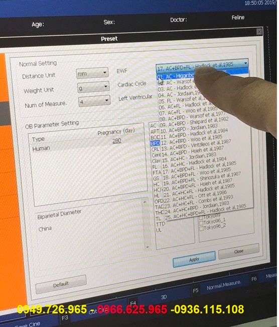 Máy siêu âm 3D CANYEARN A65
