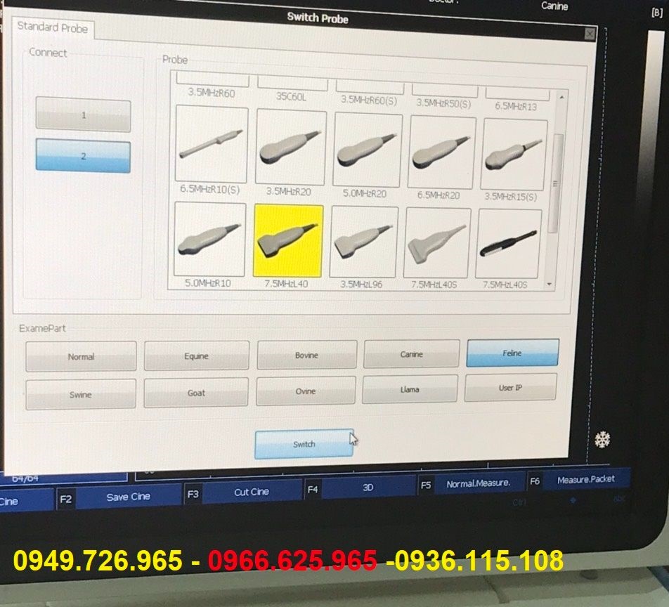 Máy siêu âm 3D CANYEARN A65