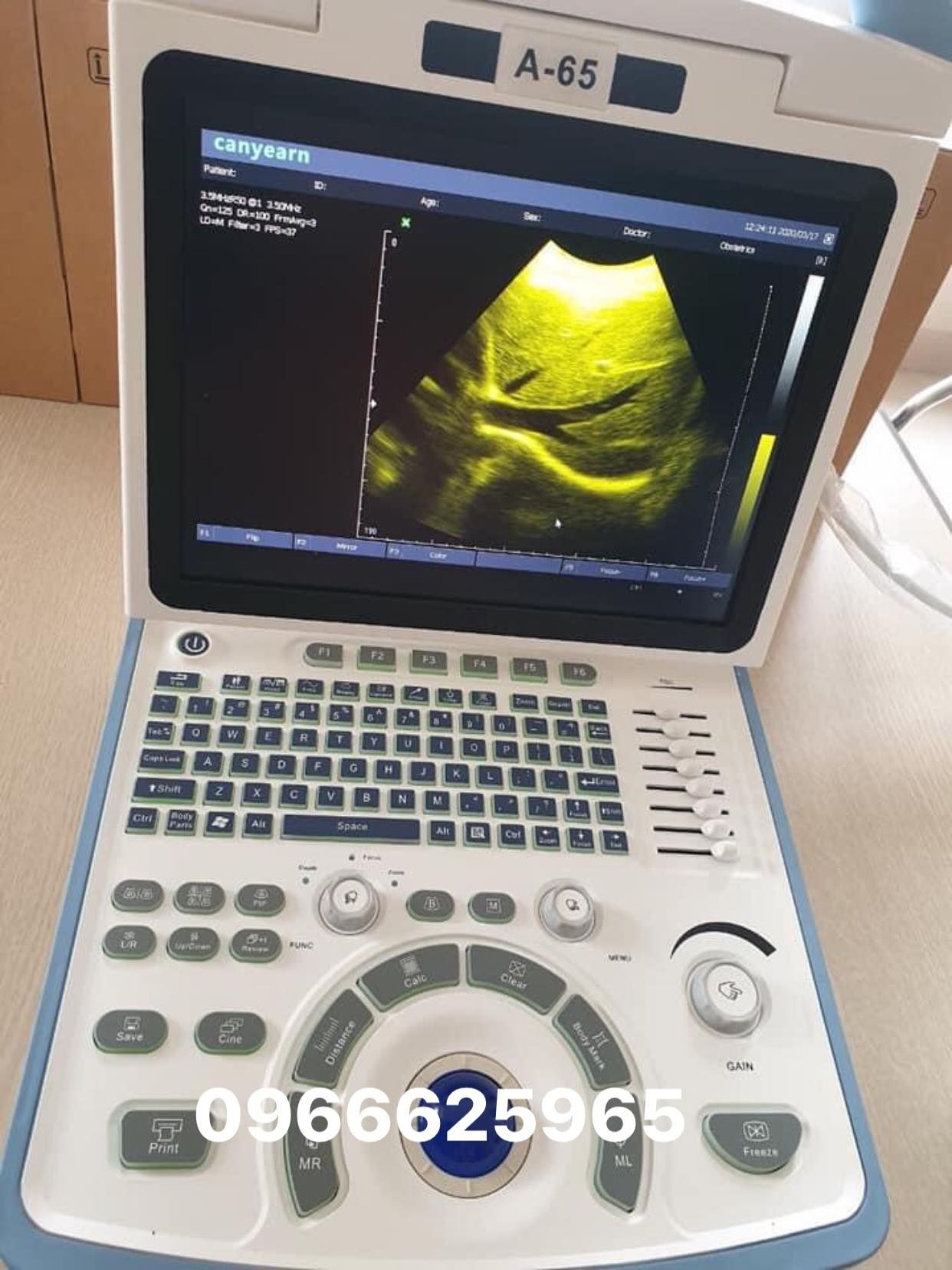 Máy siêu âm 3D CANYEARN A65