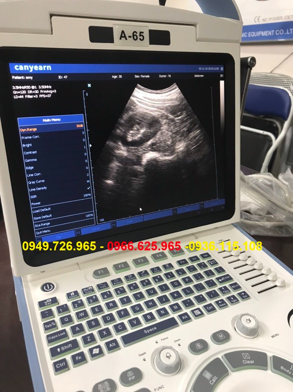 Máy siêu âm 3D CANYEARN A65