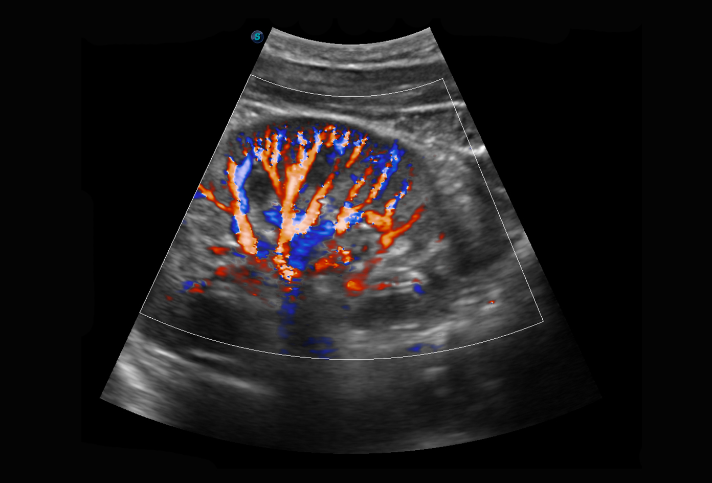 Máy siêu âm 5D Sonoscape P10 Plus