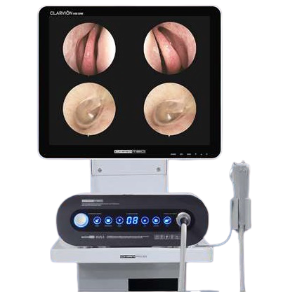 Máy nội soi tai mũi họng Chamed XVS3