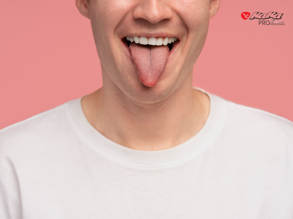 Lưỡi là nơi tích tụ vi khuẩn gây hôi miệng