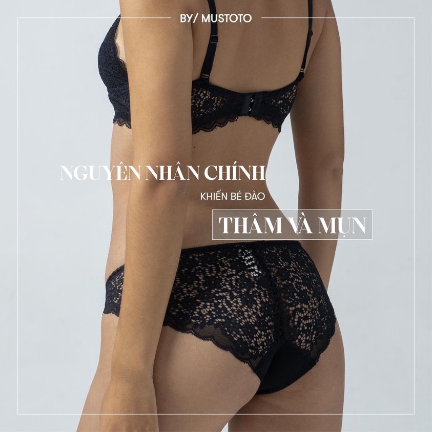 NGUYÊN NHÂN CHÍNH KHIẾN