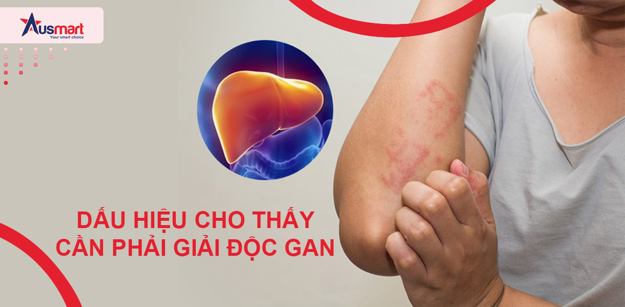 Khi nào cần giải độc gan