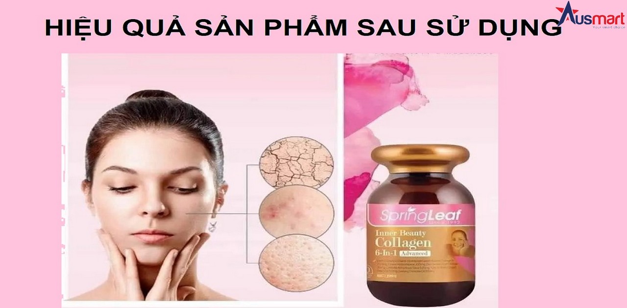 hiệu quả sử dụng Collagen Úc 6-In-1 Spring Leaf Inner Beauty 