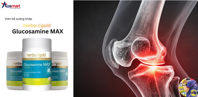 Thực phẩm chức năng hỗ trợ xương khớp  Herbs of Gold Glucosamine MAX