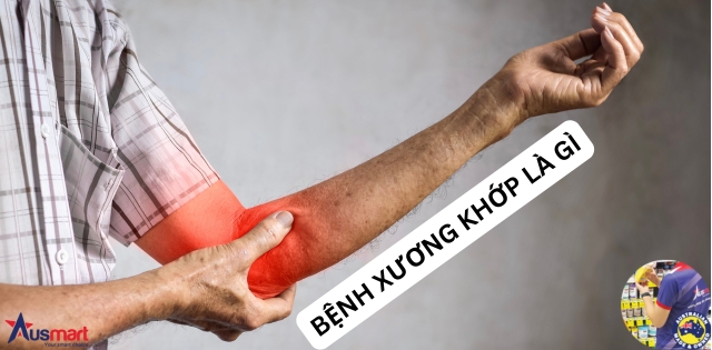 Bệnh xương khớp là gì Bệnh xương khớp là gì