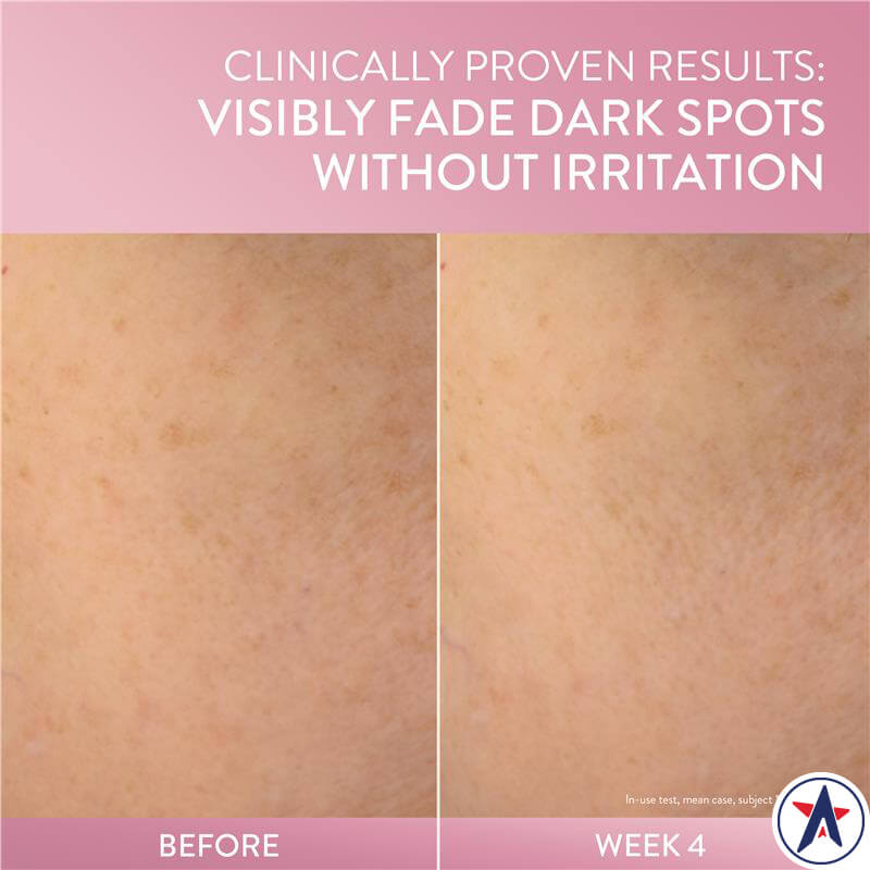 Kem dưỡng sáng da ban đêm Cetaphil Bright Healthy Radiance Brightening Night Comfort Cream 50g