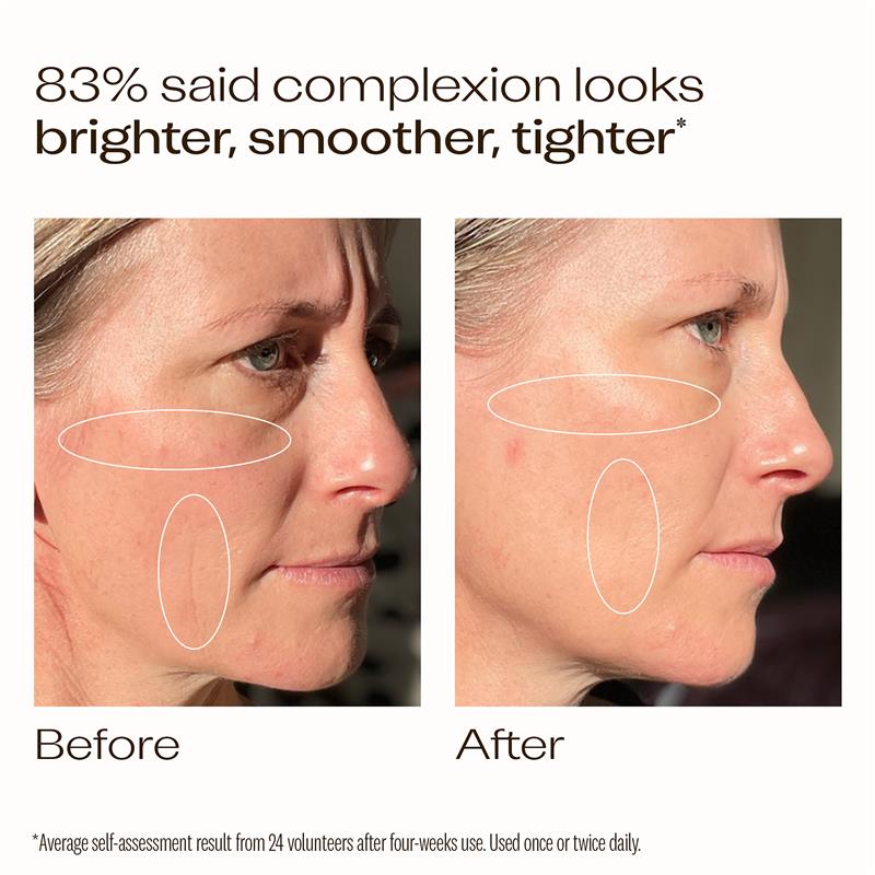 Tinh chất sáng da Vitamin C Trilogy Super Serum