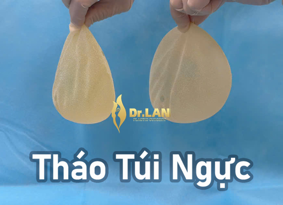 Vỡ túi ngực sau 40 năm: Cảnh báo sức khỏe và lời khuyên từ TS.BS. Hoàng Lan