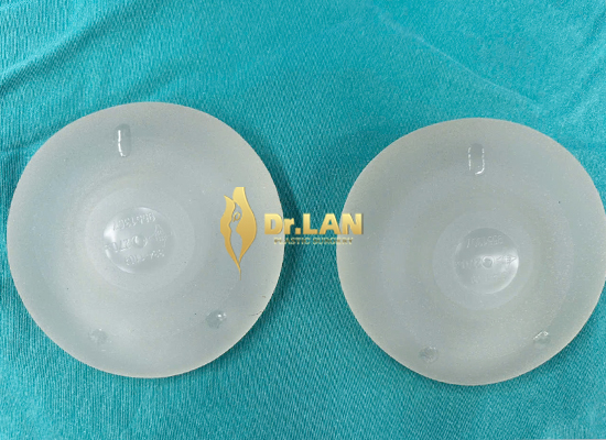 Nguy cơ rạn vỡ túi ngực khi chụp mammography - Thu Hiền, 31 tuổi – Hà Nam