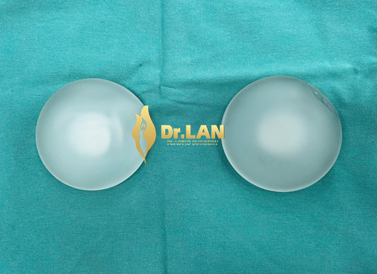 Một số câu hỏi thắc mắc thường gặp liên quan thay túi ngực