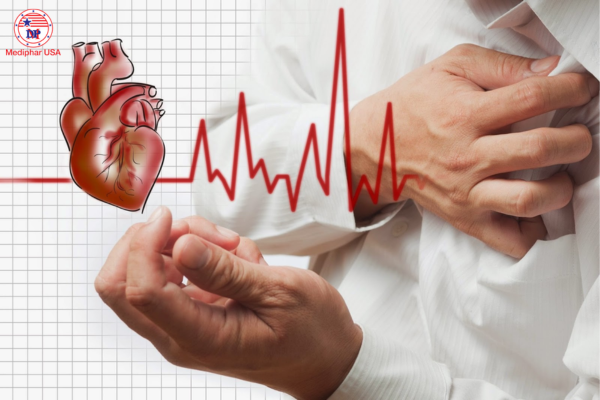 Bệnh nhồi máu cơ tim có di truyền không?