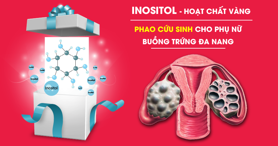 Inositol – “Phao cứu sinh” của phụ nữ buồng trứng đa nang