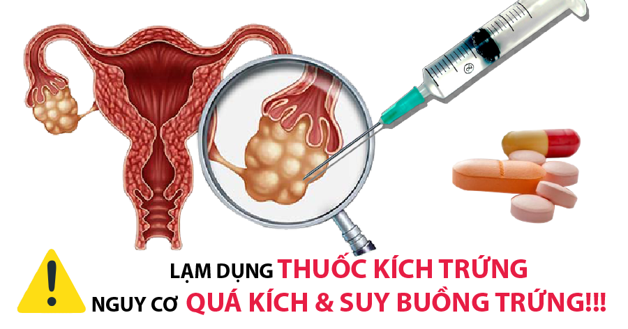 Thuốc kích trứng – Con dao 2 lưỡi cho buồng trứng của bạn!