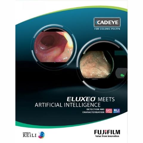 CADEYE-Nội soi kết hợp trí thông minh nhân tạo (AI)