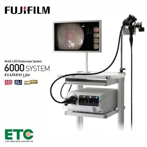 EP-6000-Bộ xử lí hình ảnh / Nguồn sáng