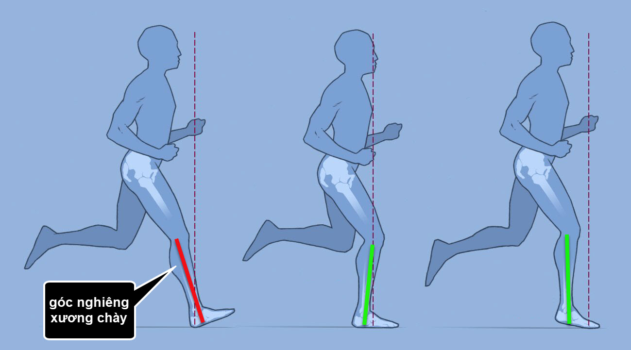 cách tập chạy bộ đúng cách, giảm chấn thương