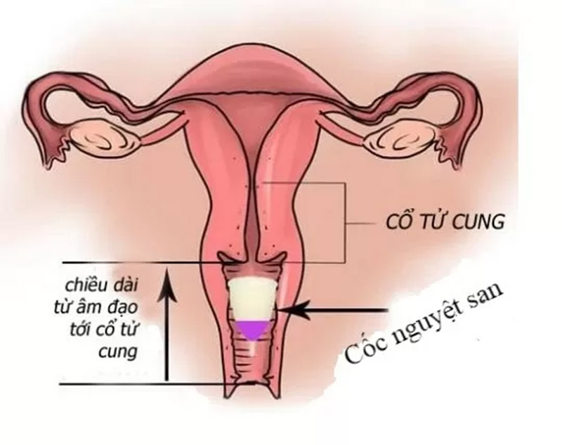 Địa Chỉ Vá Màng Trinh An Toàn  Uy Tín Nhất TP HCM  Phụ Khoa HCM
