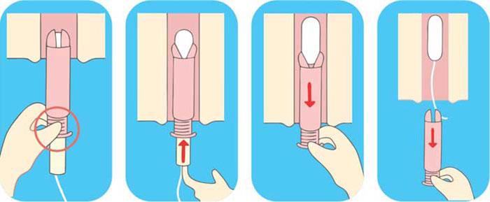 Hướng dẫn cách đặt tampon đúng cách