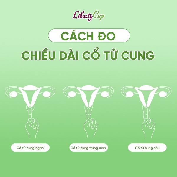 Bạn có thể dùng ngón tay trỏ để tự đo chiều dài cổ tử cung dễ dàng.