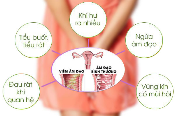 Ngứa, mẩn đỏ là dấu hiệu phổ biến của viêm nhiễm phụ khoa