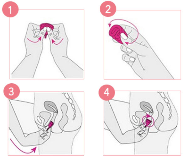 Xác định vị trí âm đạo và cổ tử cung để đặt cốc nguyệt san đúng vị trí