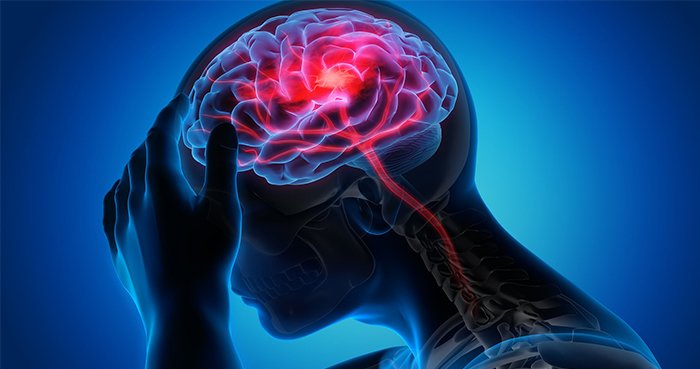 TẠI SAO ĐỘT QUỴ NÃO CÓ XU HƯỚNG TRẺ HÓA