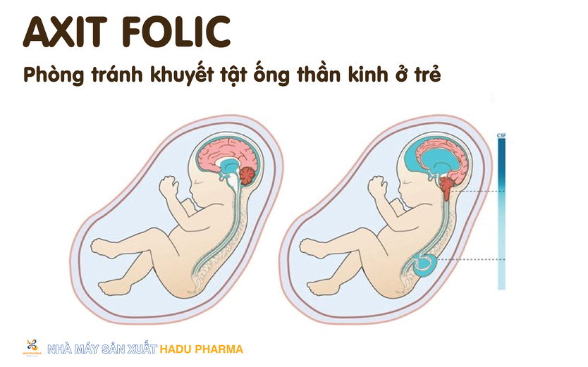 Axit folic có thể phòng tránh khuyết tật ống thần kinh trong giai đoạn thai kỳ