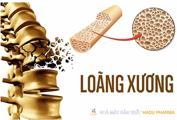 Aquamin F giảm tình trạng loãng xương, hỗ trợ quá trình điều trị bệnh về xương khớp.