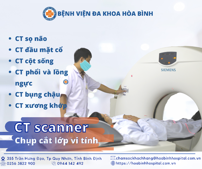 CHỤP CẮT LỚP VI TÍNH TẠI BỆNH VIỆN ĐA KHOA HÒA BÌNH