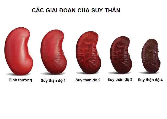 DẤU HIỆU CẢNH BÁO SUY THẬN