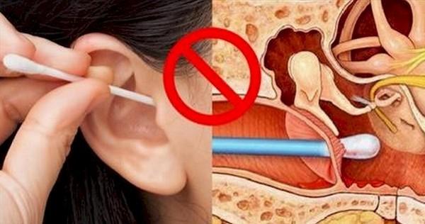 Phát hiện khối u ác tính sau nhiều năm vệ sinh tai sai cách, chuyên gia cảnh báo từ bỏ ngay sai lầm này