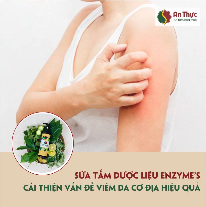VIÊM DA CƠ ĐỊA - NỖI LO DAI DẲNG CỦA NHIỀU NGƯỜI VIÊM DA CƠ ĐỊA - NỖI LO DAI DẲNG CỦA NHIỀU NGƯỜI