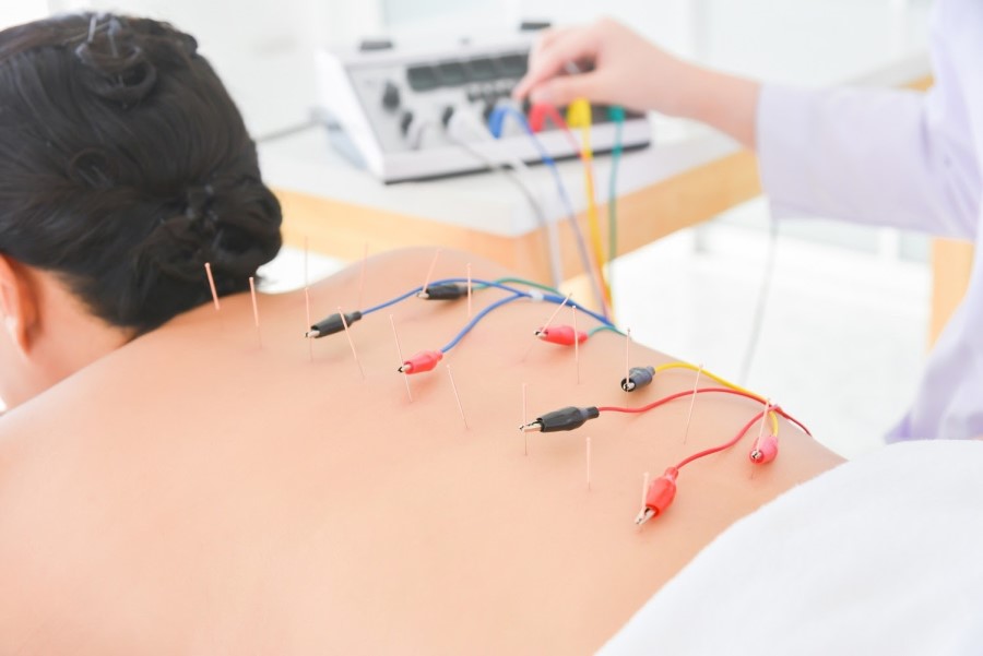 Tìm hiểu các tác dụng của phương pháp châm cứu theo Y học cổ truyền TRƯỜNG  TRUNG CẤP Y KHOA VIỆT NAM