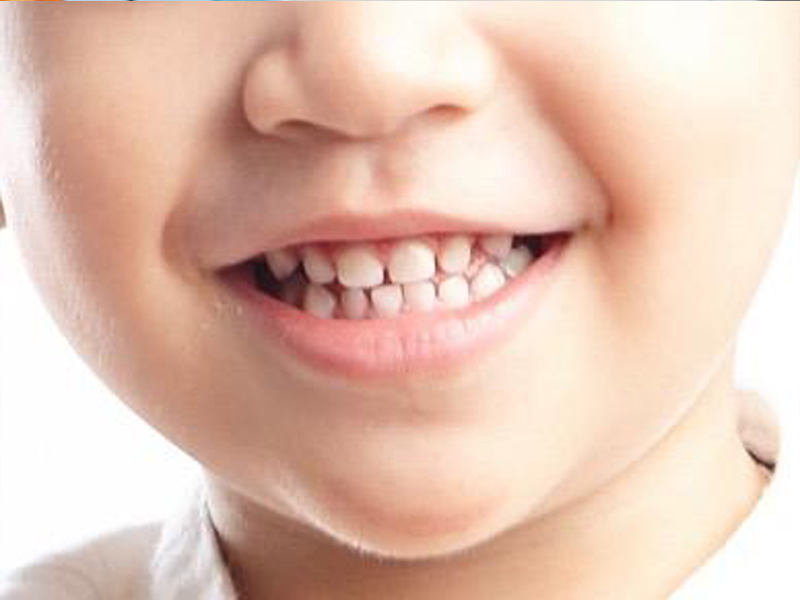 Tầm quan trọng của răng sữa