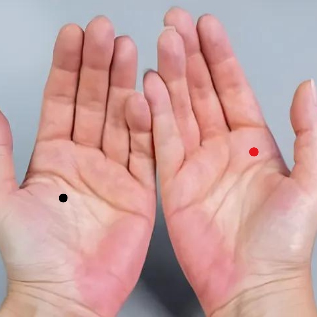 Nổt ruồi son nốt ruồi đen trên bàn tay có ý nghĩa gì